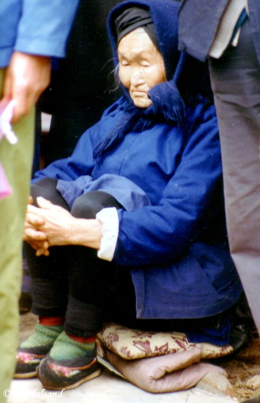Kunming street view. Old lady with small feet. The ancient custom of tying the feet of young girls was prohibited after the revolution. One can still see a few old women who have gone through this terrible ordeal. China - Kunming